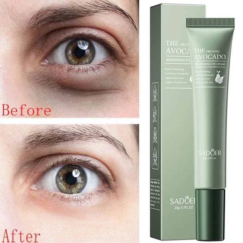Crème pour les yeux, élimine les cernes, Anti-rides, estompe les ridules, hydratante, soulage la pea