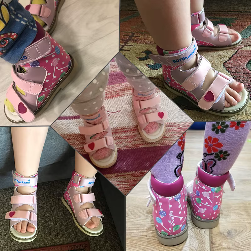 Informations sur Uckland-Sandales d'été pour filles, chaussures Orth4WD pour enfants, style coréen, 