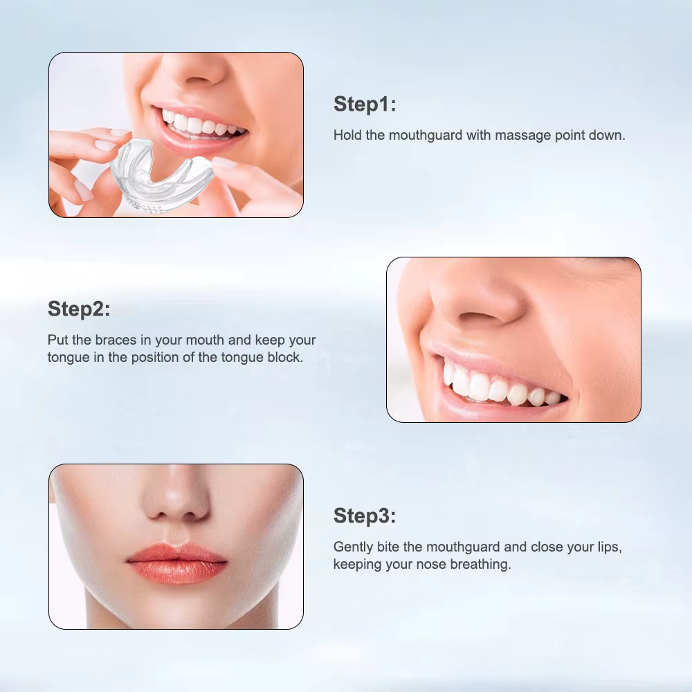 Appareil dentaire, accolades orthodontiques, entraîneur de dents, entraîneur d'alignement, embout po