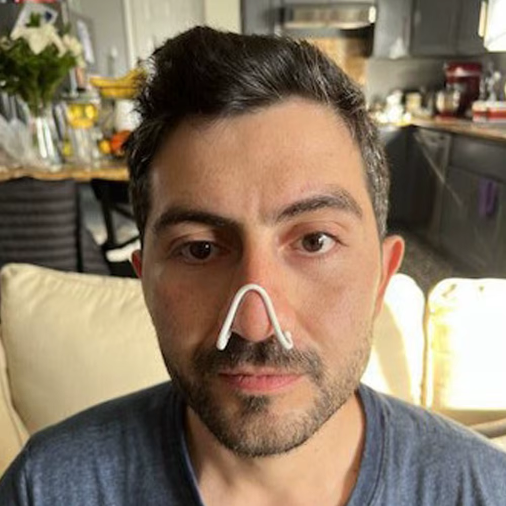 Dilatateur Nasal pour soulager le ronflement, pince-nez Anti-ronflement en Silicone, améliore l'éven