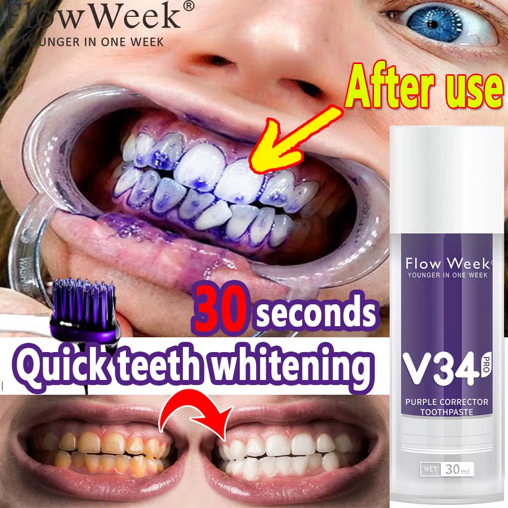 Flow-du-- Dentifrice orthodontique V34 Pro, Protection des dents, Soin de l'émail dentaire, Décontam