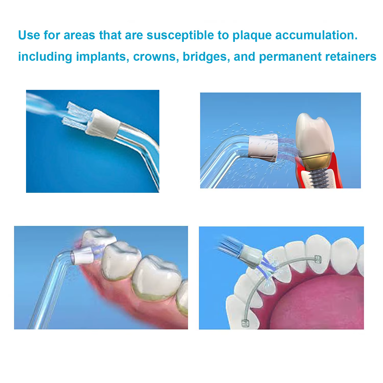 Embout de recherche de Plaque pour remplacement de fil dentaire Waterpik et autre marque d'irrigateu