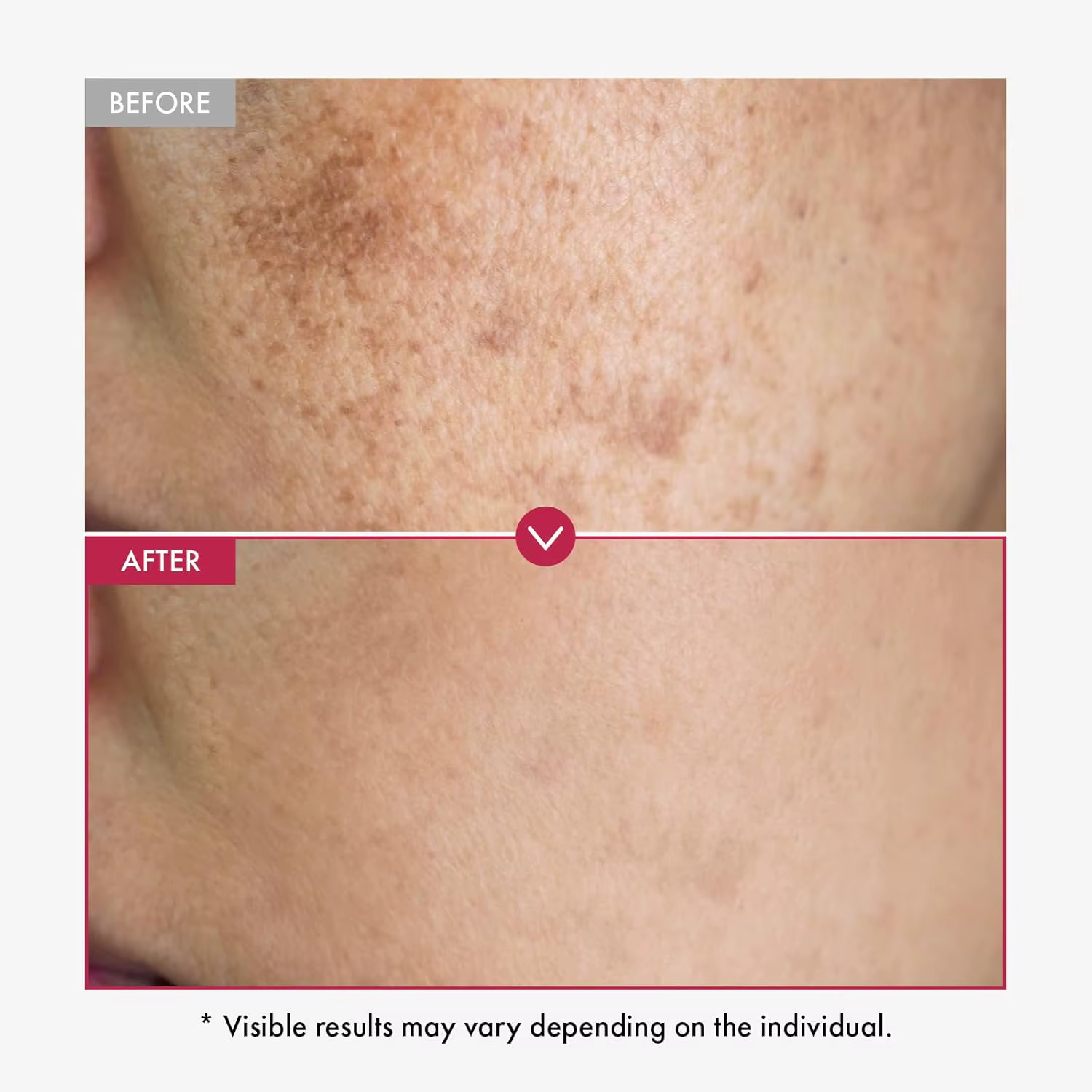 Sérum visage blanchissant pour la peau, 500ml, réduit les taches, hydratant, même le teint, avec Alp